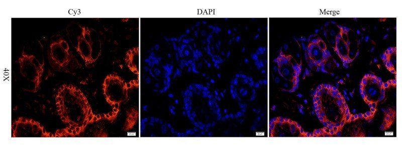 EGFR isoform a variant antibody