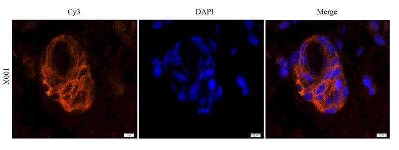 EGFR isoform a variant antibody