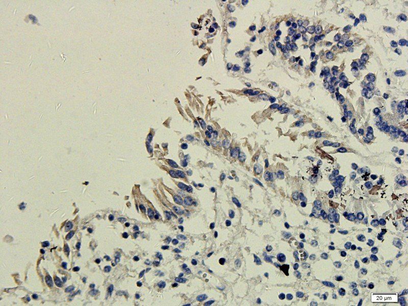 EGFR isoform a variant antibody