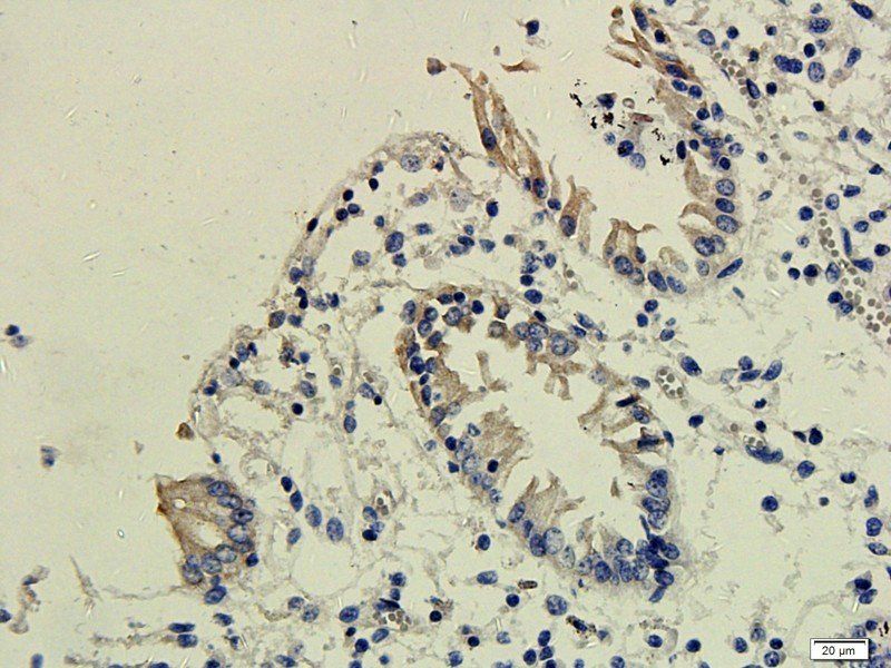 EGFR isoform a variant antibody