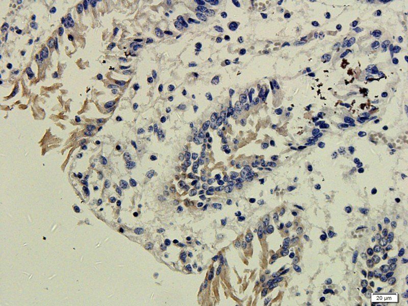 EGFR isoform a variant antibody