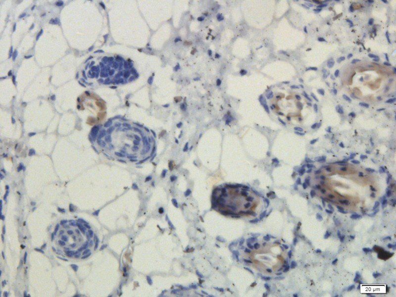 EGFR isoform a variant antibody