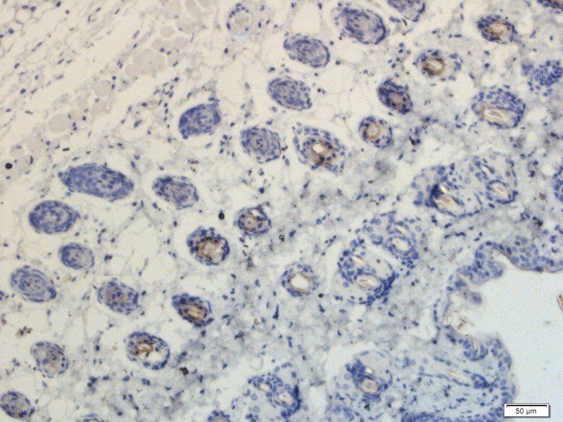 EGFR isoform a variant antibody