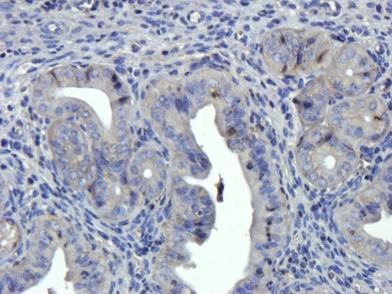 EGFR isoform a variant antibody