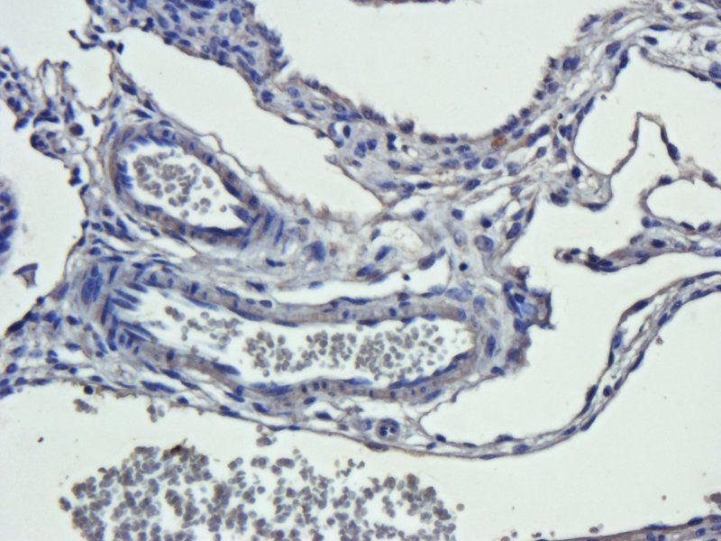 EGFR isoform a variant antibody