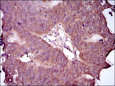 EGFR mutant (L858R)