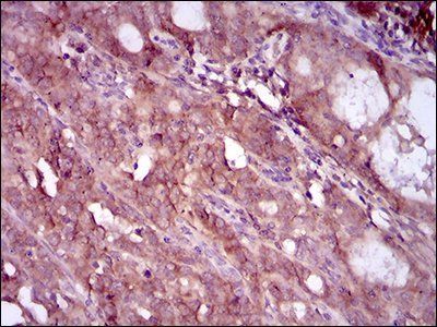 EGFR mutant (L858R)