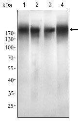 EGFR mutant (L858R)