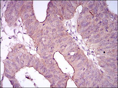 EGFR mutant (L858R)