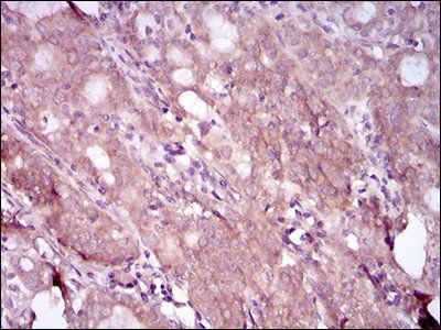 EGFR mutant (L858R)