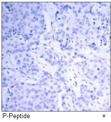 EGFR (Phospho-Tyr1092) Antibody