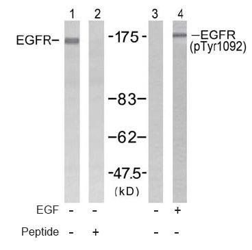 EGFR (Phospho-Tyr1092) Antibody