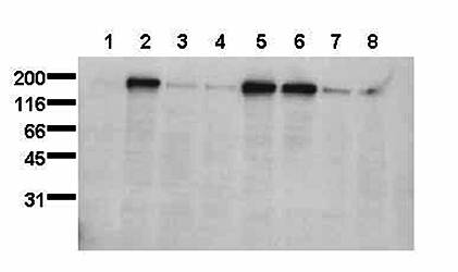 MAB TO EGFR PS1047