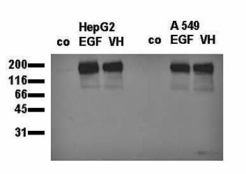 MAB TO EGFR PTYR 845