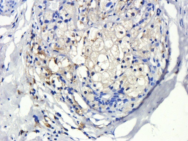 EGFRvIII antibody