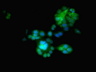 Egl nine homolog 2 antibody