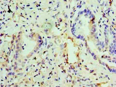 Egl nine homolog 2 antibody