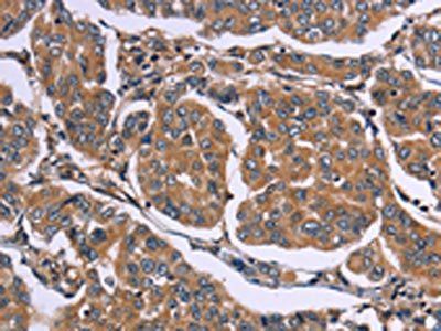 EGR4 Antibody