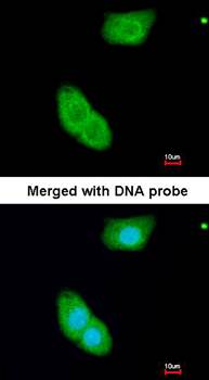 EHBP1 antibody