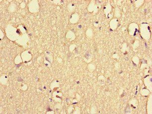 EHD3 Antibody