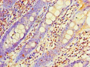 EHHADH Antibody