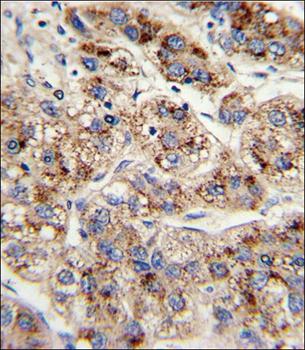EHHADH Antibody (C-term)