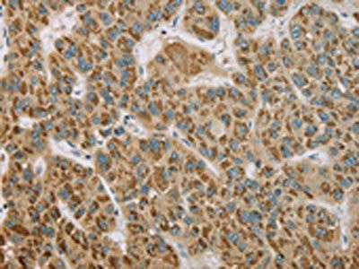 EHHADH Antibody