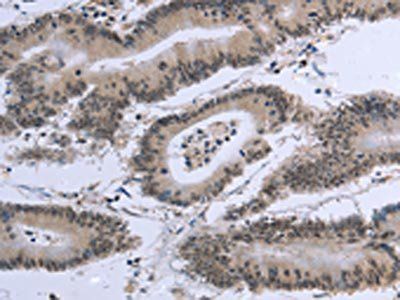 EID1 Antibody