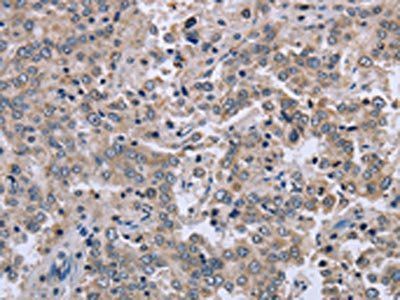 EID1 Antibody