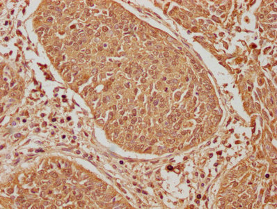 EIF2AK2 Antibody