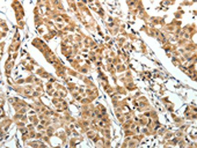 EIF2AK3 Antibody