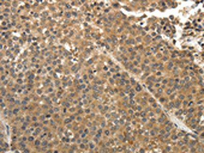 EIF2AK3 Antibody