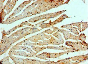 EIF2AK4 Antibody