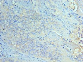 EIF2AK4 Antibody