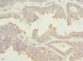 EIF2B1 antibody