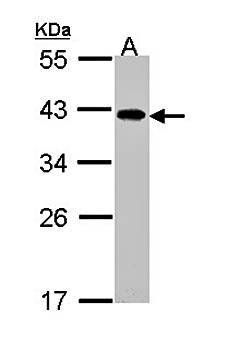 eIF2B beta antibody