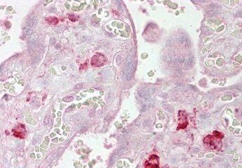 Goat anti-EIF2C1 / AGO1 Antibody