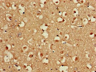 EIF2S1 Antibody