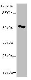 EIF2S3 Antibody