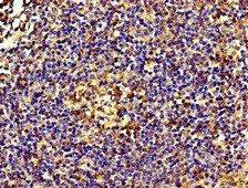 ACTN4 Antibody