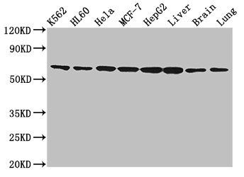ACTN4 Antibody