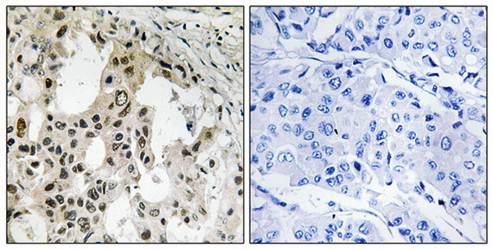 EIF3D Antibody