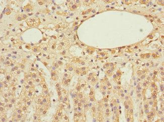 EIF3F Antibody