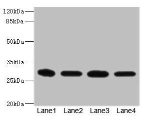 EIF3K antibody