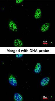 eIF3K antibody