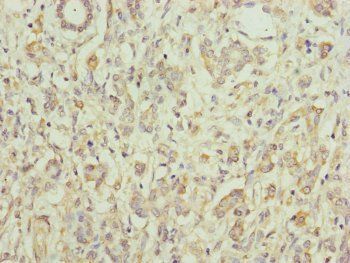 EIF3M Antibody