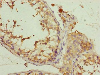 EIF3M Antibody