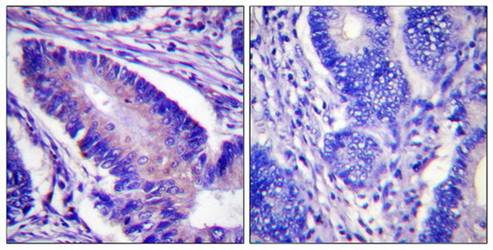 eIF4B (phospho-Ser422) antibody