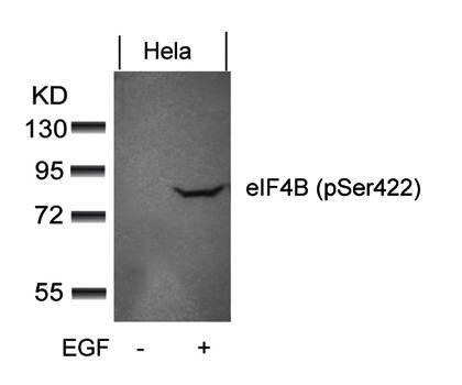 eIF4B (phospho-Ser422) Antibody
