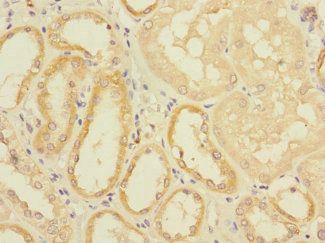 EIF4E2 Antibody